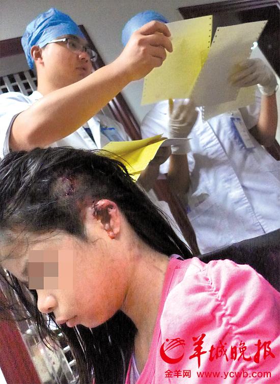 受傷的11歲女孩頭發(fā)被卷入扶梯，耳朵被嚴(yán)重拉傷，需手術(shù)。