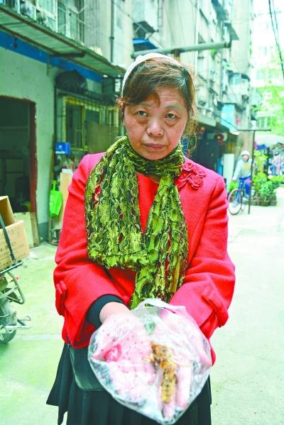 頭部受傷的黃女士展示兩根大魚(yú)刺。