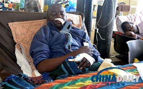 雖然已經(jīng)在醫(yī)院接受了近一個月的恢復(fù)治療，卡托卡的身體仍然非常虛弱。