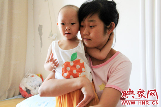 孩子和媽媽在一起，她的右眼已經(jīng)失明。