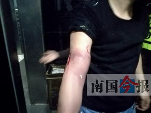 覃先生手臂被卡的部位受傷流血，所幸傷勢無大礙。 通訊員 王建民 攝