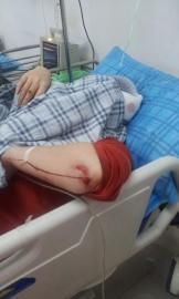 砸窗當(dāng)事人胡女士在醫(yī)院接受治療。