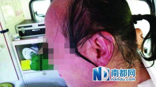 涉事教師遭熱水潑臉后的照片。