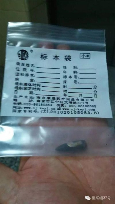 經(jīng)警方鑒定，秦女士體內(nèi)取出的子彈系56式步槍射出 。 受訪者供圖