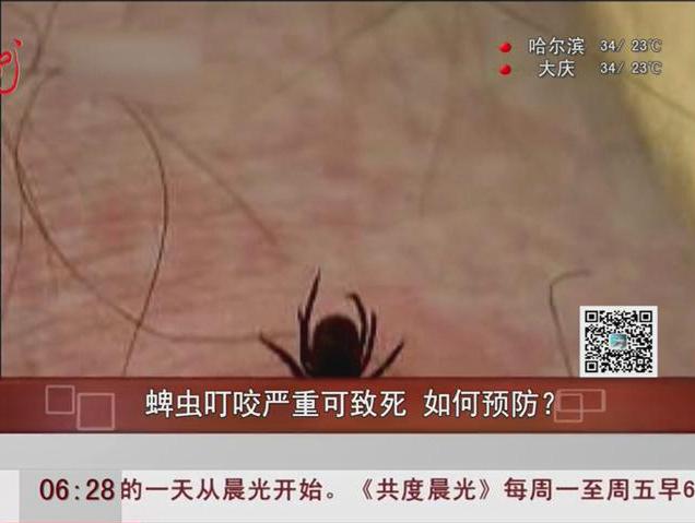蜱蟲(chóng)叮咬嚴(yán)重可致死如何預(yù)防？