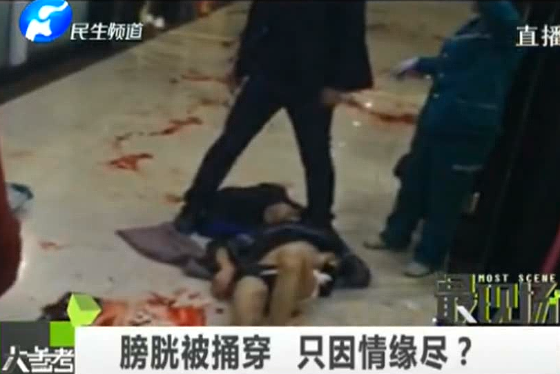 膀胱被捅穿 只因情緣盡？